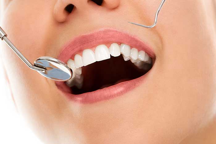 imagem endodontia
