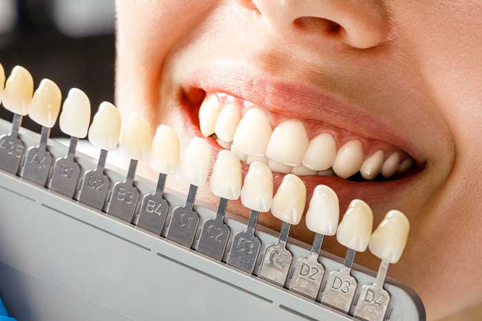 imagem prótese dentária